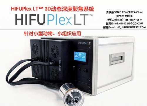 Sonic Concepts HIFUPlex LT? 2D+3DȾ۽ϵͳ